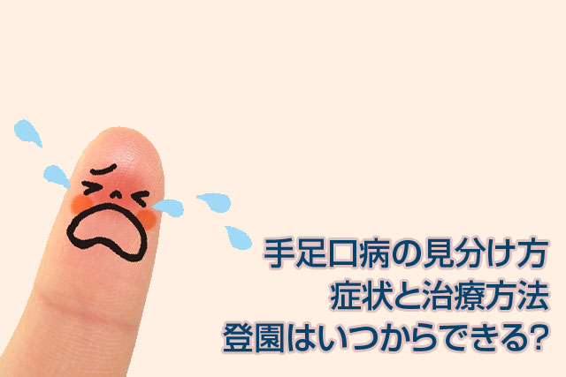 手足口病の見分け方,症状と治療方法,登園はいつから